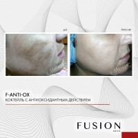 F-ANTI-OX (Мезококтейль против фотостарения), 10 мл